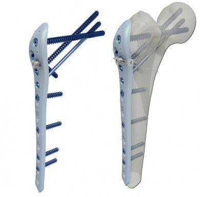 FEMUR KIRIKLARI image 1